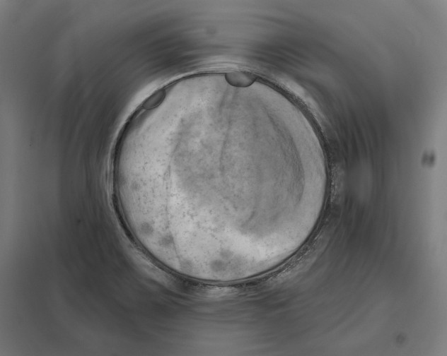 X0000097591467200803280916