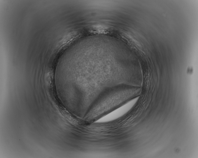 X0000097600747200803141916