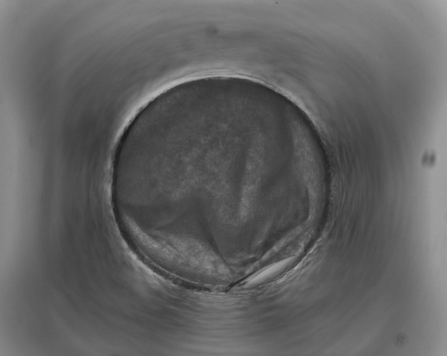 X0000097601508200803141905
