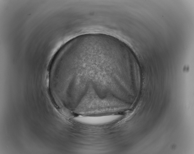 X0000097601509200803141905