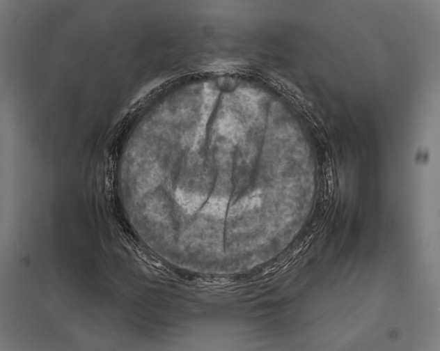 X0000097601158200803280944