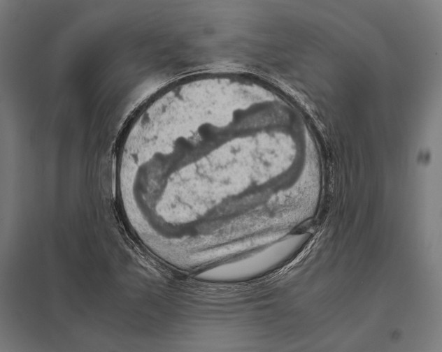 X0000097601171200803280944