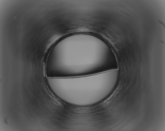 X0000097611171200802290749