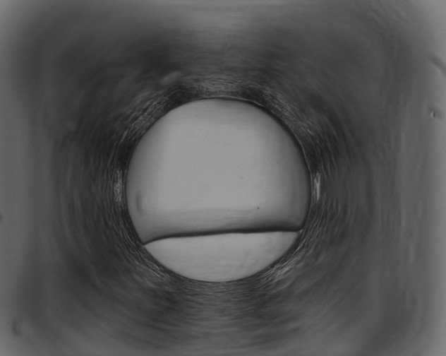 X0000097611251200802290747