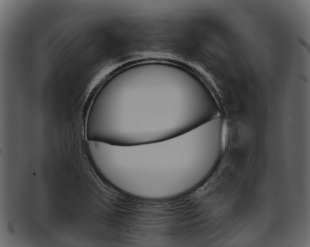 X0000097611271200802290747