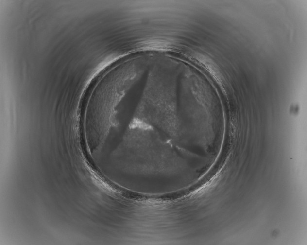 X0000097610779200803071449