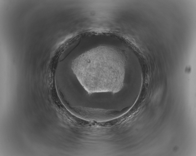 X0000097611398200803071440
