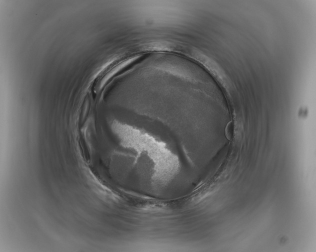 X0000097610386200803141944