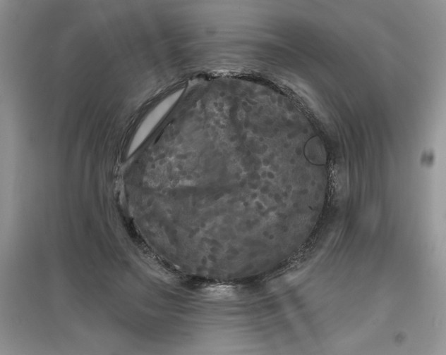 X0000097610499200803141942