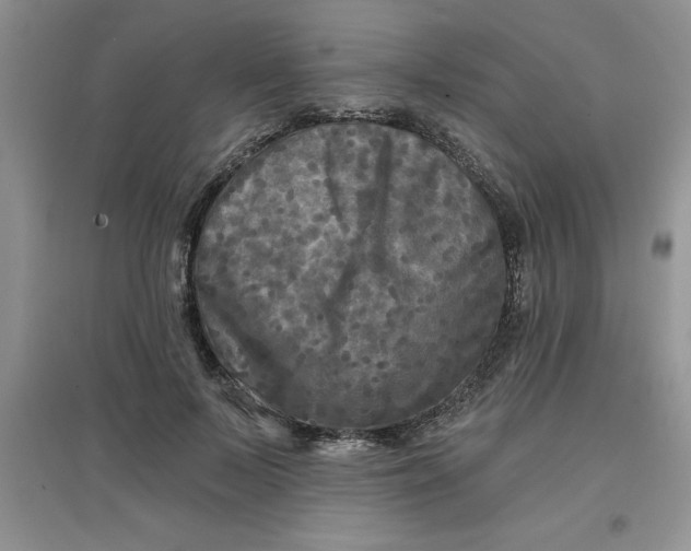 X0000097610695200803141939