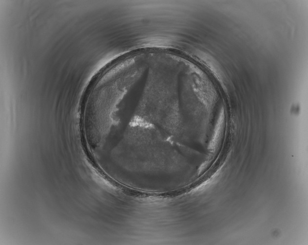 X0000097610779200803141938