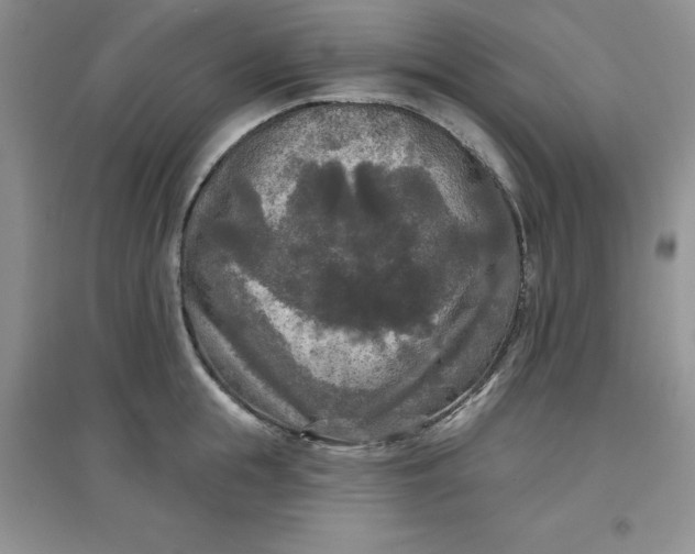 X0000097610855200803141938