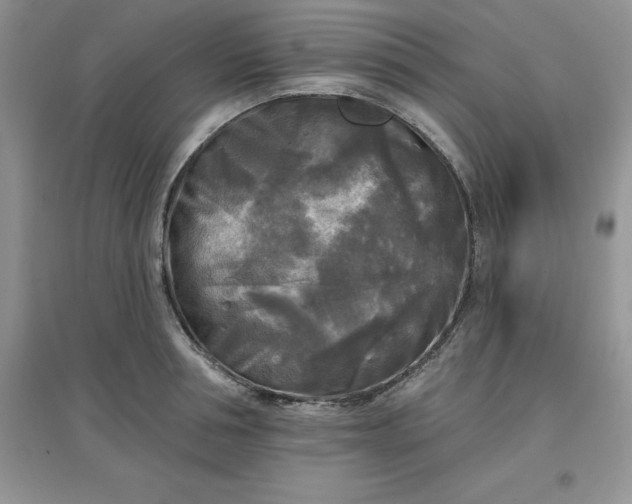 X0000097610994200803141935