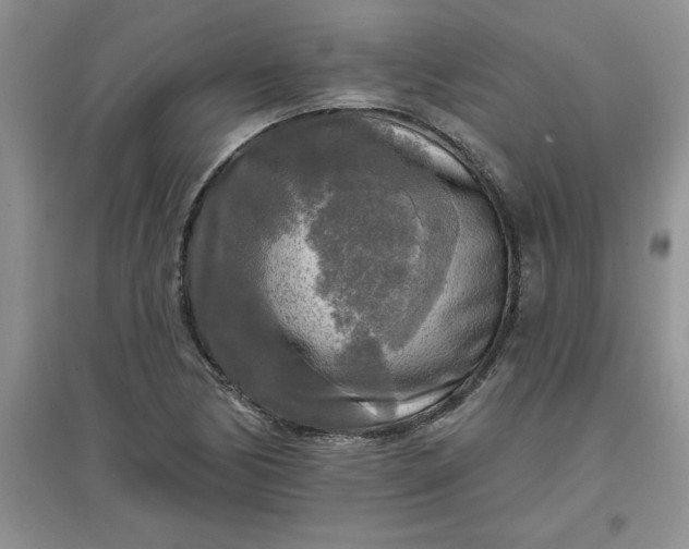 X0000097611170200803141932