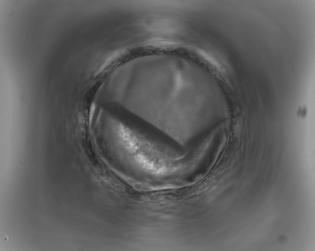 X0000097611397200803141929