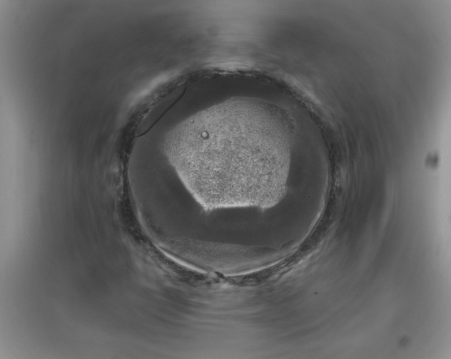 X0000097611398200803141929