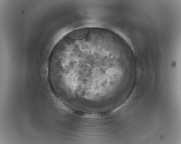 X0000097611415200803141929