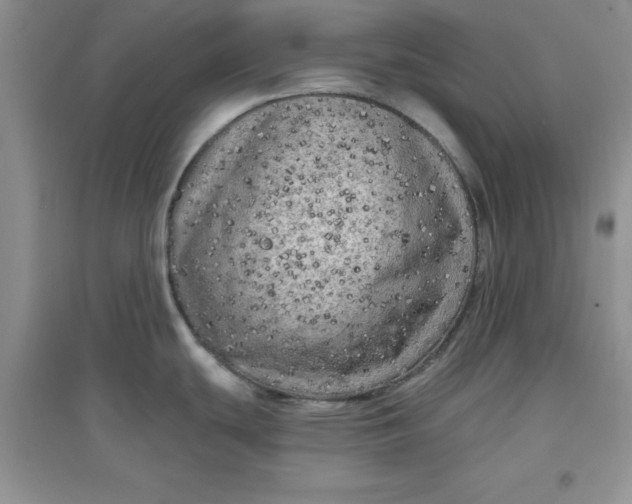 X0000097611439200803141929