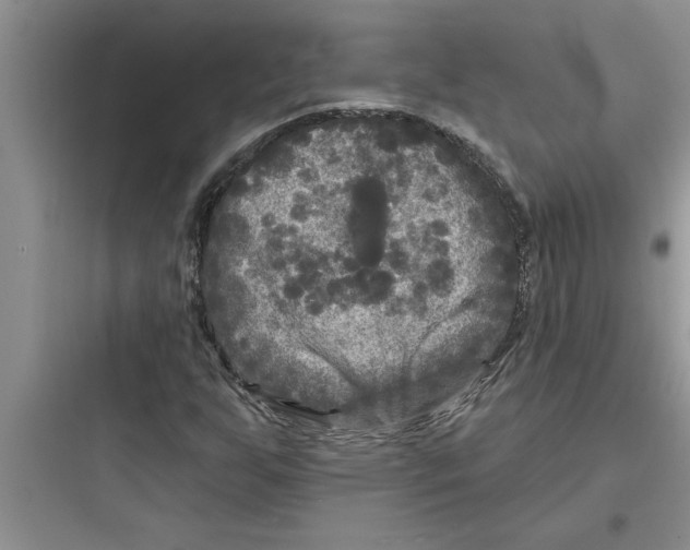 X0000097611255200803211715