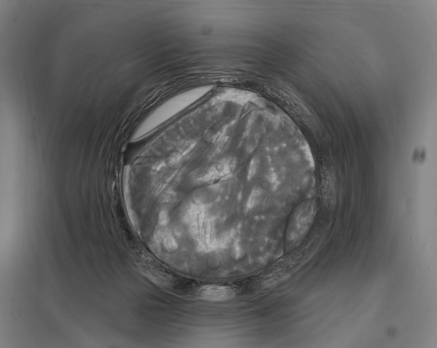 X0000097610169200803281021