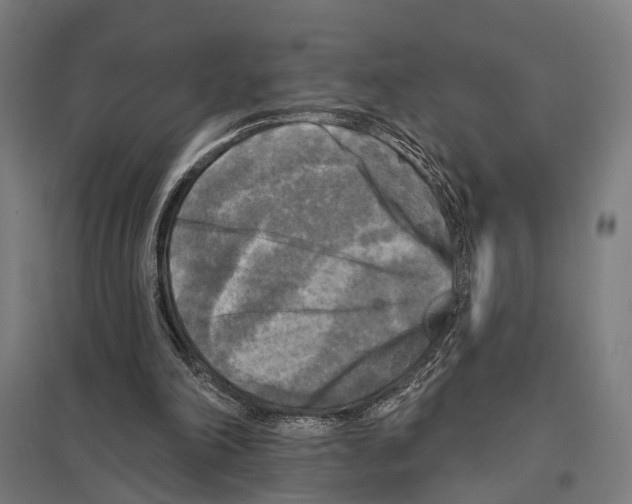 X0000097610198200803281021