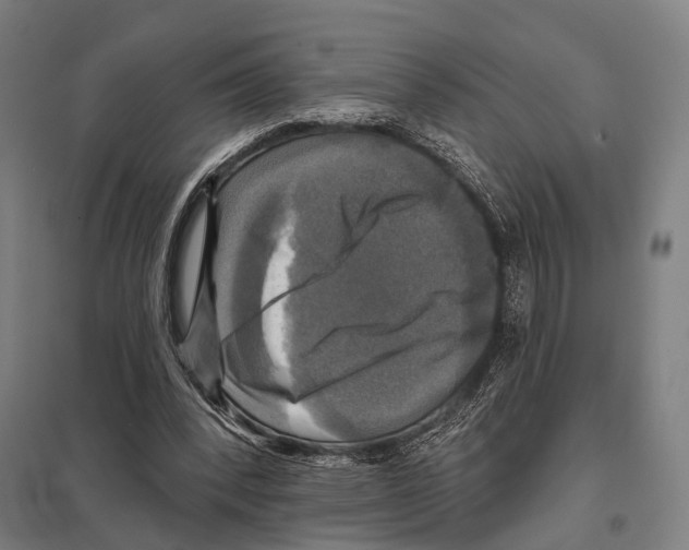 X0000097610392200803281018