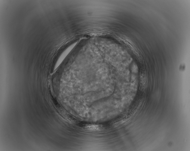 X0000097610499200803281017