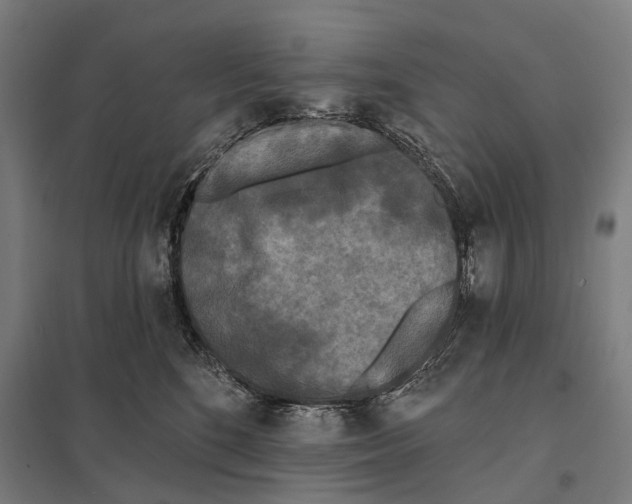 X0000097610520200803281016