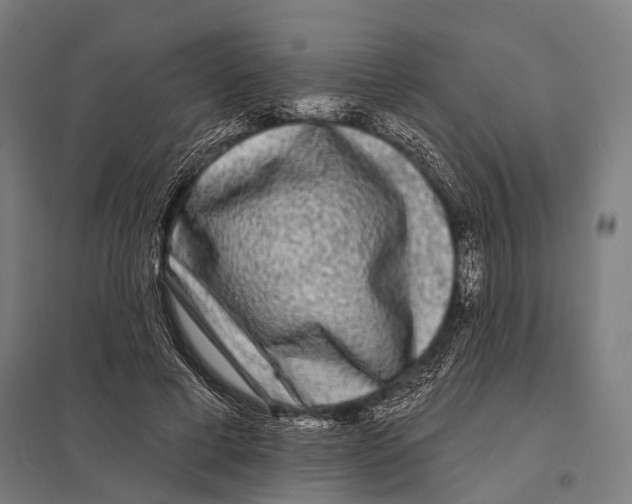 X0000097610593200803281015