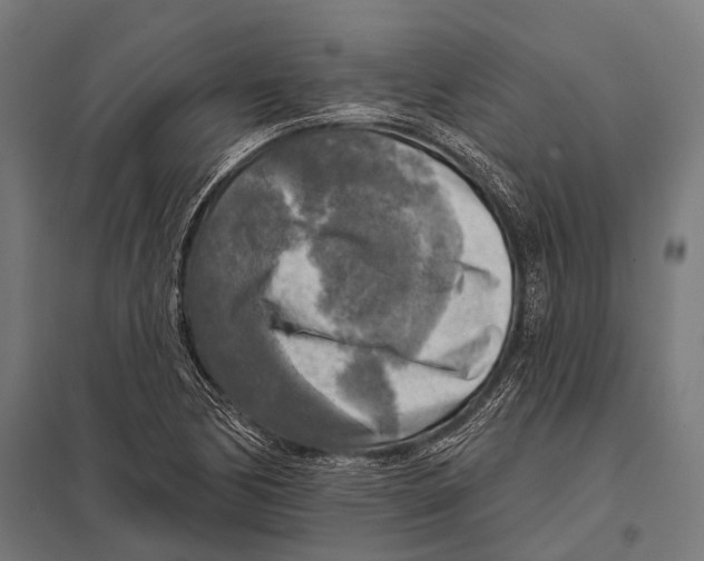 X0000097611170200803281007