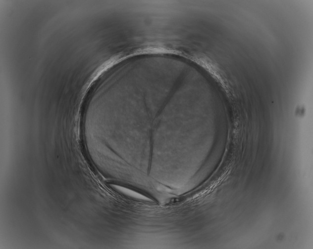 X0000097611173200803281007