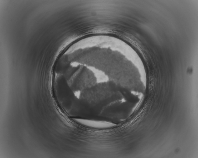 X0000097611179200803281007