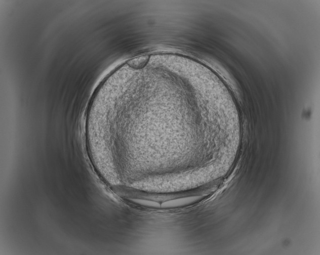 X0000097611198200803281006