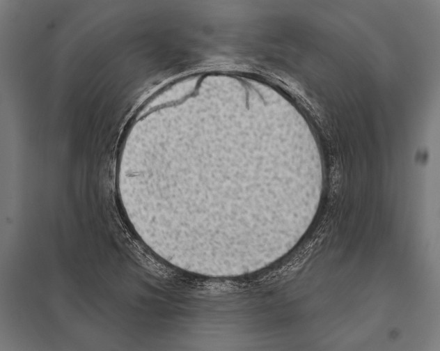 X0000097611220200803281006