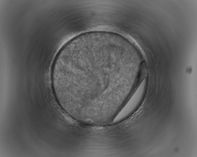 X0000097611230200803281006