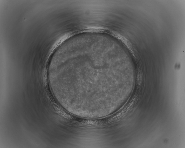 X0000097611362200803281004