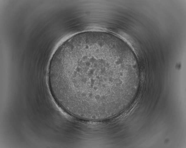 X0000097611379200803281004