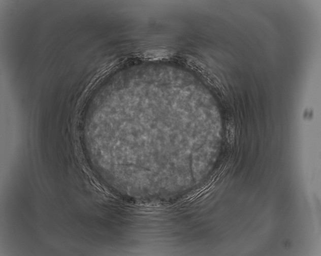 X0000097611393200803281003