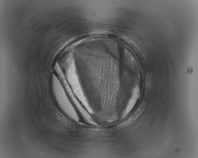 X0000097611401200803281003