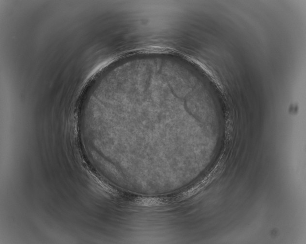 X0000097611402200803281003