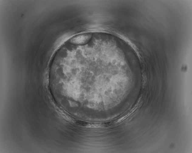 X0000097611415200803281003