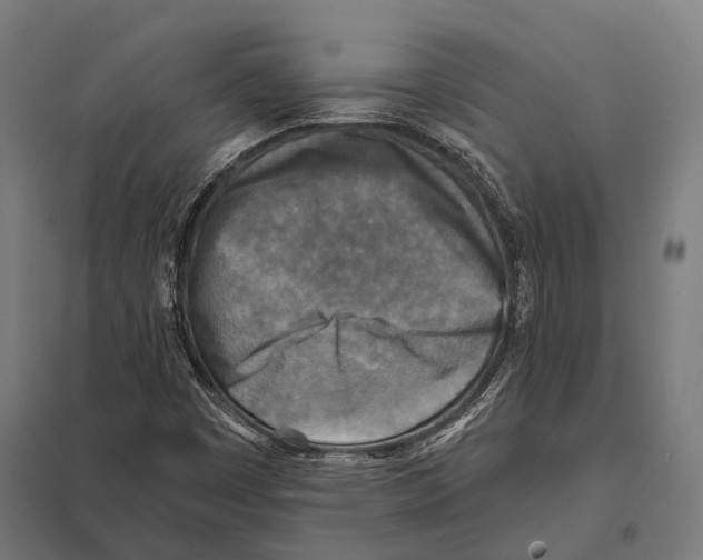 X0000097611449200803281003