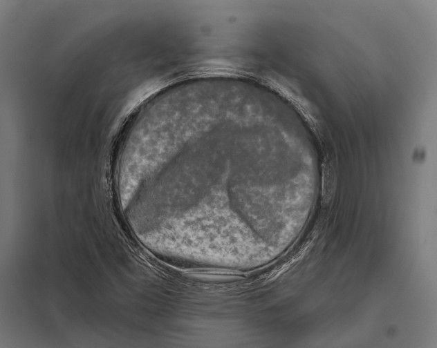 X0000097611453200803281003