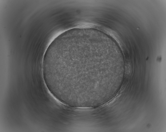 X0000097611487200803281002