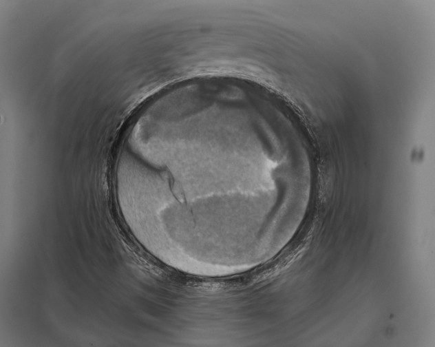 X0000097611497200803281002