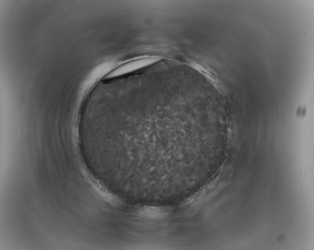 X0000097620149200803142010