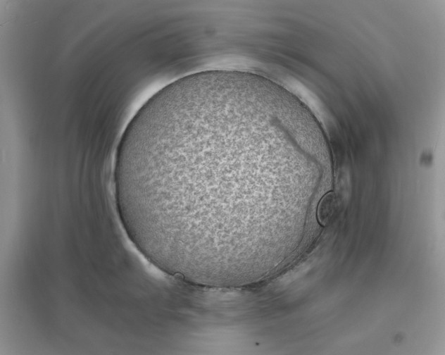 X0000097621103200803141956