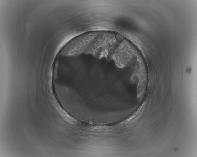 X0000097621179200803141955