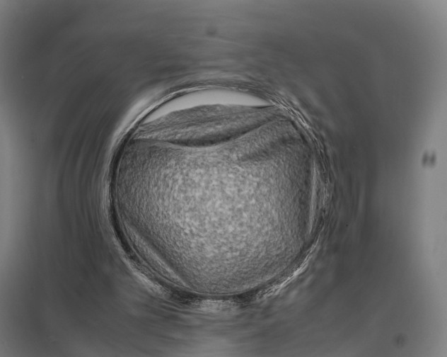 X0000097620101200803281045