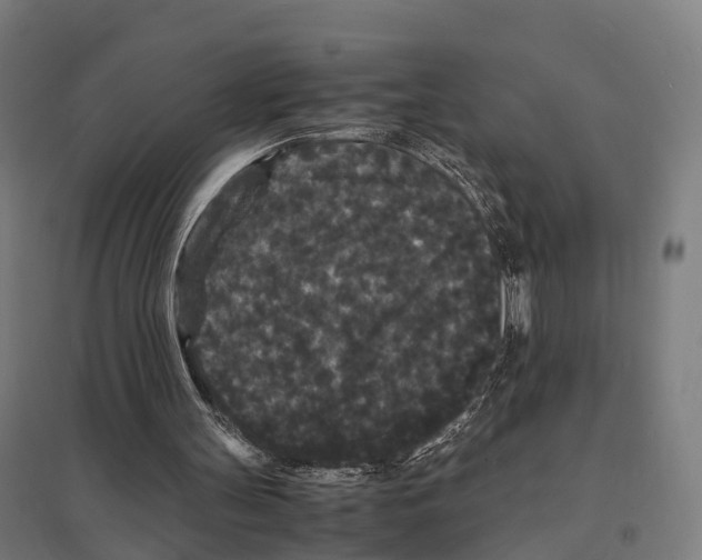 X0000097620147200803281044